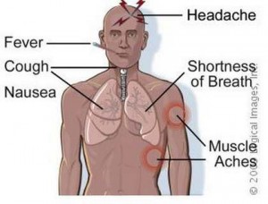 Legionnare disease symptoms & signs