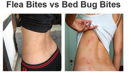 flea bites vs bed bugs