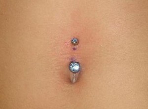 Infected Belly Button Piercing image