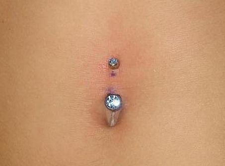 Infected Belly Button Piercing – Pictures, Symptoms, Treatment