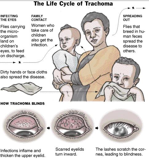 Lifecycle of trachoma picture