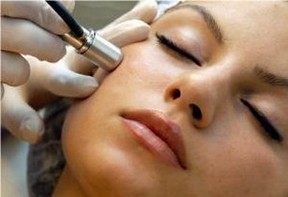 Microdermabrasion Side Effects