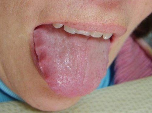 A tongue with mild teeth markings on the sides.image